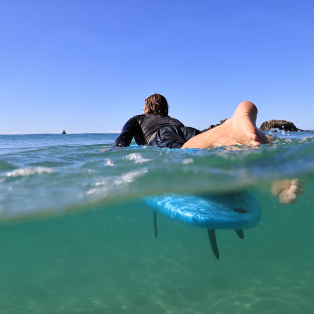 Vision Surfboard Ignite